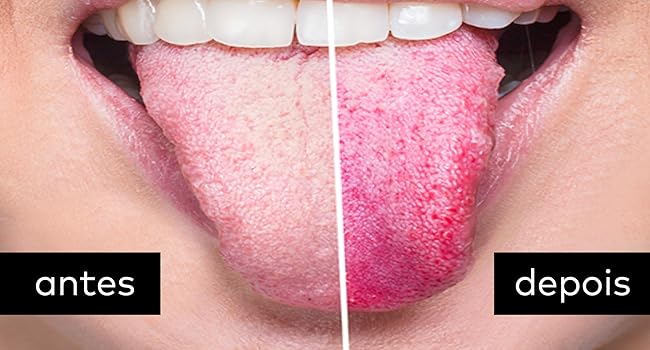 Limpador de Língua PREMIUM - Remove mais de 80% das bactérias